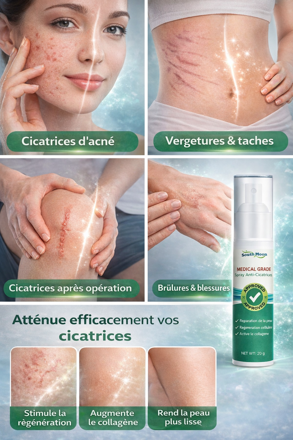 Spray Anti-Cicatrices – South Moon✅️