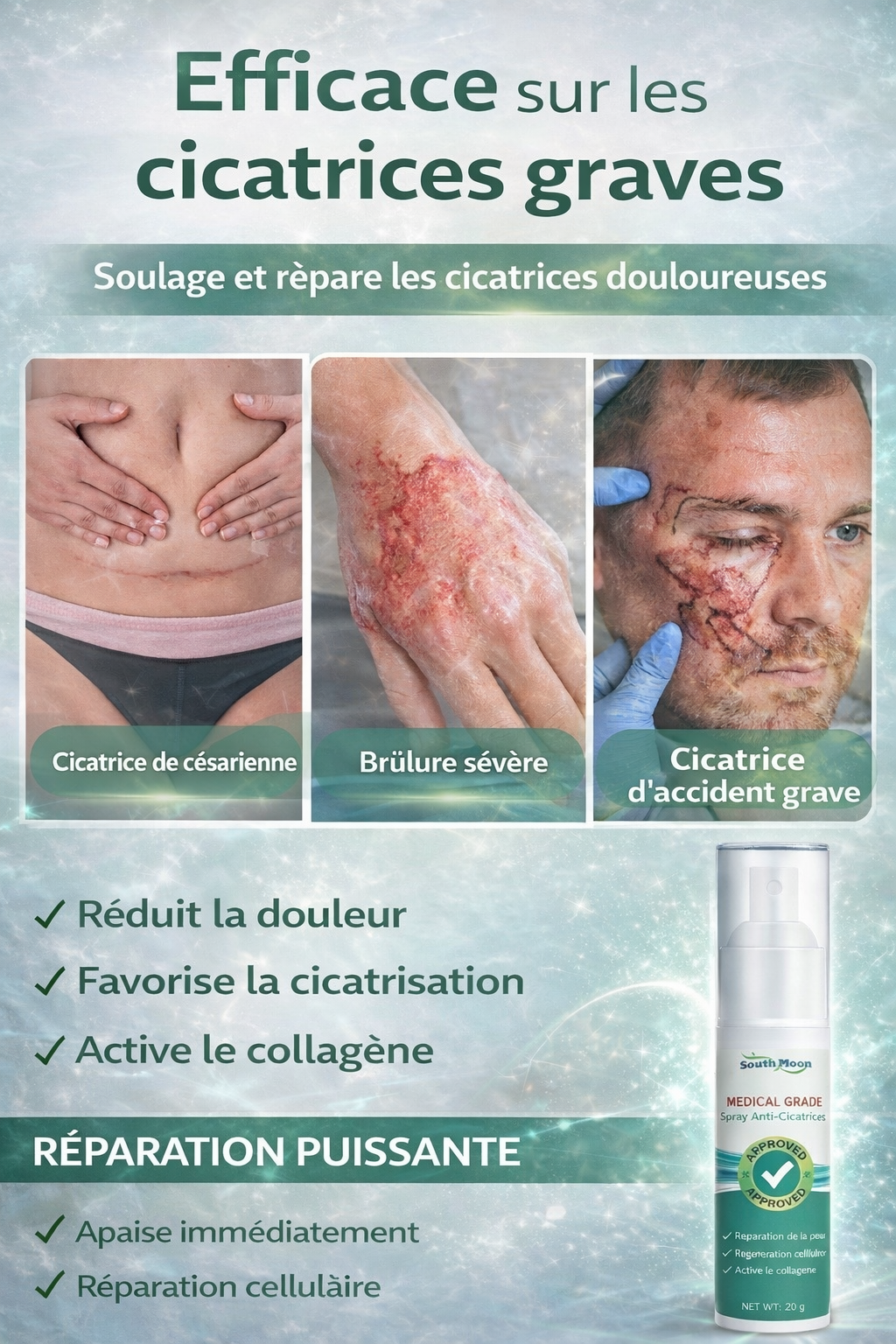 Spray Anti-Cicatrices – South Moon✅️