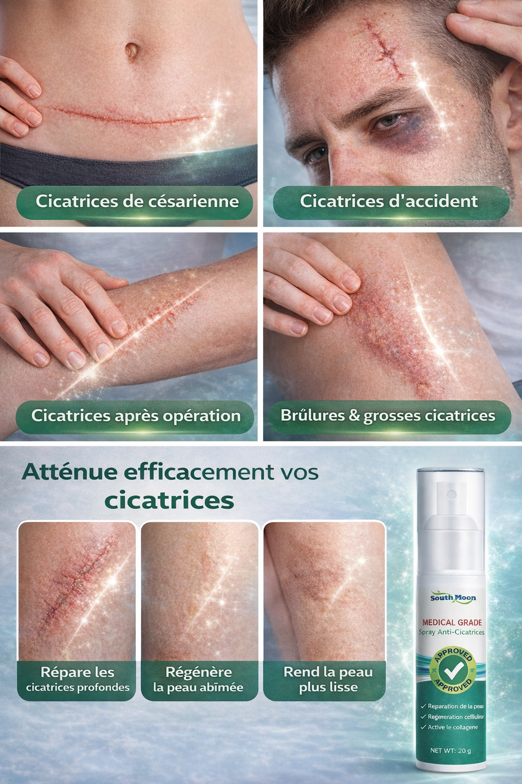 Spray Anti-Cicatrices – South Moon✅️